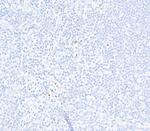 FOXP3 Antibody in Immunohistochemistry (Paraffin) (IHC (P))