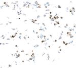 VISTA Recombinant Rabbit Monoclonal Antibody (BLR035F)