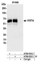 VISTA Antibody in Immunoprecipitation (IP)