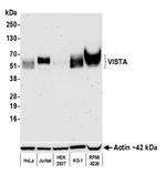 VISTA Antibody in Western Blot (WB)