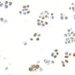 MED1 Recombinant Rabbit Monoclonal Antibody (BLR037F)