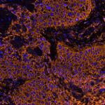 CD44 Antibody in Immunohistochemistry (Paraffin) (IHC (P))