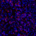 CD8 alpha Antibody in Immunohistochemistry (Paraffin) (IHC (P))