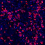 CD8 alpha Antibody in Immunohistochemistry (Paraffin) (IHC (P))