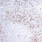 CD8 alpha Antibody in Immunohistochemistry (Paraffin) (IHC (P))