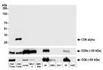CD8 alpha Antibody in Western Blot (WB)