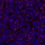 TIGIT Antibody in Immunohistochemistry (Paraffin) (IHC (P))