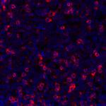 TIGIT Antibody in Immunohistochemistry (Paraffin) (IHC (P))