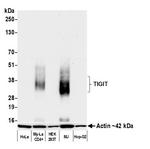 TIGIT Antibody in Western Blot (WB)