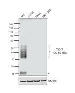 TIGIT Antibody in Western Blot (WB)