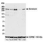 Senataxin Recombinant Rabbit Monoclonal Antibody (BLR050F)