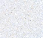 CD137 Antibody in Immunohistochemistry (Paraffin) (IHC (P))
