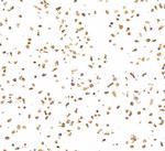 CD30 Recombinant Rabbit Monoclonal Antibody (BLR055F)