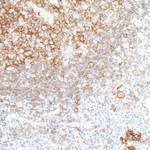 CD40 Antibody in Immunohistochemistry (Paraffin) (IHC (P))