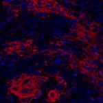 CD40 Antibody in Immunohistochemistry (Paraffin) (IHC (P))