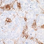 CD40 Antibody in Immunohistochemistry (Paraffin) (IHC (P))