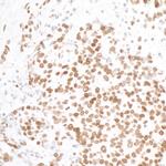 H2AX Antibody in Immunohistochemistry (Paraffin) (IHC (P))