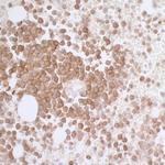 CD33 Recombinant Rabbit Monoclonal Antibody (BLR061G)