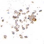 DNAM-1/CD226 Antibody in Immunocytochemistry (ICC/IF)