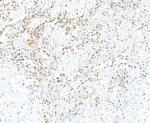 DNAM-1/CD226 Antibody in Immunohistochemistry (Paraffin) (IHC (P))