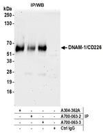 DNAM-1/CD226 Antibody in Immunoprecipitation (IP)