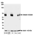 DNAM-1/CD226 Antibody in Western Blot (WB)