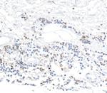 CD96 Antibody in Immunohistochemistry (Paraffin) (IHC (P))