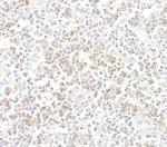 CD96 Antibody in Immunohistochemistry (Paraffin) (IHC (P))