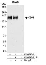 CD96 Antibody in Immunoprecipitation (IP)
