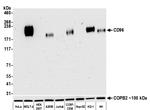 CD96 Antibody in Western Blot (WB)
