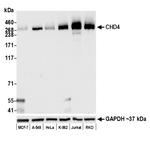 CHD4 Recombinant Rabbit Monoclonal Antibody (BLR066G)