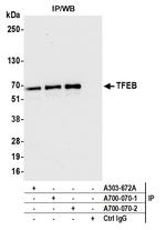 TFEB Antibody in Immunoprecipitation (IP)