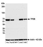 TFEB Recombinant Rabbit Monoclonal Antibody (BLR070G)