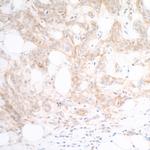 Nectin-2/CD112 Antibody in Immunohistochemistry (Paraffin) (IHC (P))