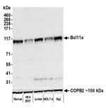 Bcl11a Recombinant Rabbit Monoclonal Antibody (BLR073G)