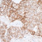 PVR/CD155 Antibody in Immunohistochemistry (Paraffin) (IHC (P))