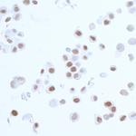 PCNA Recombinant Rabbit Monoclonal Antibody (BLR075G)