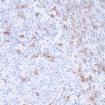 PD-1 Recombinant Rabbit Monoclonal Antibody (BLR076G)