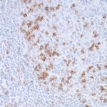 PD-1 Antibody in Immunohistochemistry (Paraffin) (IHC (P))