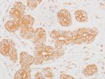 MEK2 Antibody in Immunohistochemistry (Paraffin) (IHC (P))