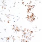 PDGFR beta Antibody in Immunocytochemistry (ICC/IF)