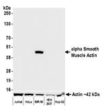 alpha Smooth Muscle Actin Antibody in Western Blot (WB)