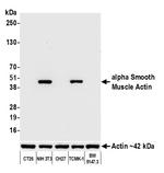 alpha Smooth Muscle Actin Antibody in Western Blot (WB)