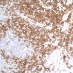 CD27 Antibody in Immunohistochemistry (Paraffin) (IHC (P))