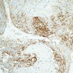 Claudin-1 Antibody in Immunohistochemistry (Paraffin) (IHC (P))