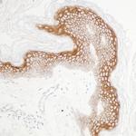 Claudin-1 Antibody in Immunohistochemistry (Paraffin) (IHC (P))