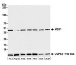 MEK1 Recombinant Rabbit Monoclonal Antibody (BLR096G)