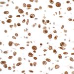 STAT3 Antibody in Immunocytochemistry (ICC/IF)