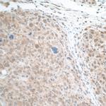 STAT3 Antibody in Immunohistochemistry (Paraffin) (IHC (P))