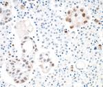 STAT3 Antibody in Immunohistochemistry (Paraffin) (IHC (P))